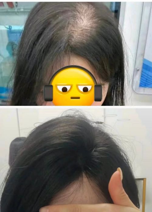 第一名草本防脱洗发水排行榜AG真人平台防脱发洗发水(图5)