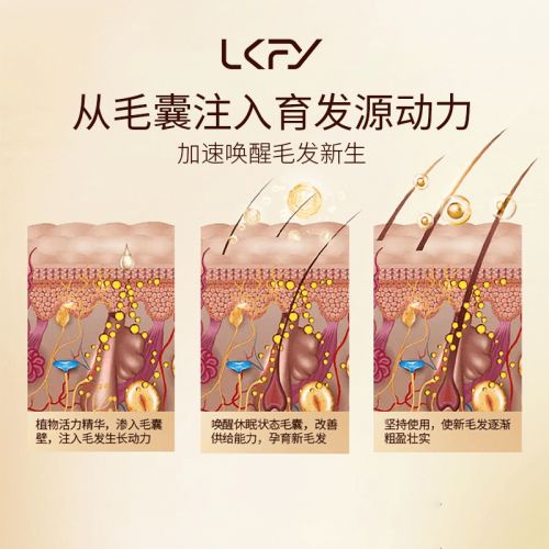 第一名草本防脱洗发水排行榜AG真人平台防脱发洗发水(图6)